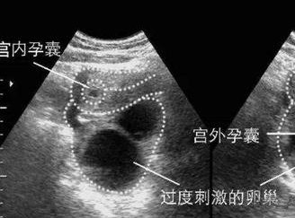 阜阳三代试管婴儿医院名单汇总，推荐阜阳试管医院
